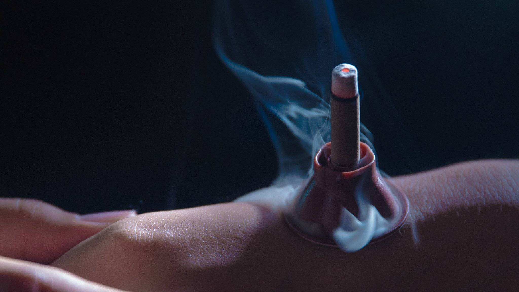 艾灸在月经期能做吗