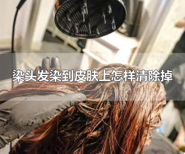 染头发染到皮肤上怎样清除掉（可用米醋将皮肤上的染发剂洗掉）