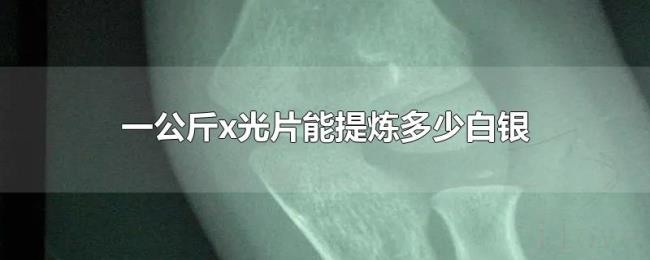 一公斤x光片能提炼多少白银 一公斤x光片能提炼多少白银