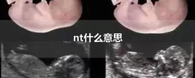 nt什么意思 nt什么意思