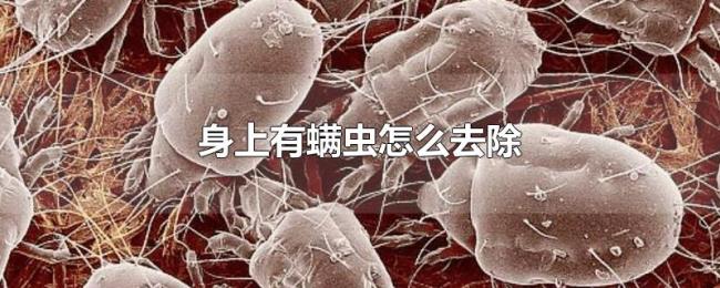 身上有螨虫怎么去除 身上有螨虫怎么去除