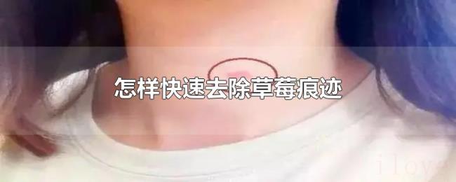 怎样快速去除草莓痕迹 怎样快速去除草莓痕迹