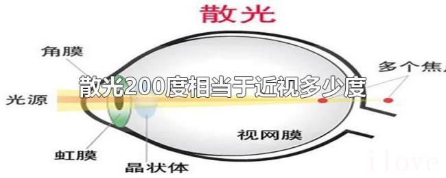 散光200度相当于近视多少度