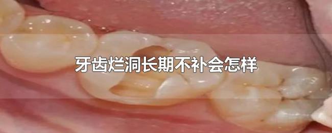 牙齿烂洞长期不补会怎样 牙齿烂洞长期不补会怎样