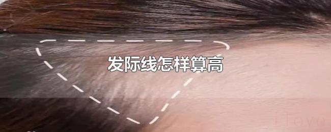 发际线怎样算高 发际线怎样算高