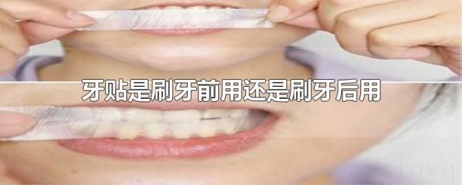 牙贴是刷牙前用还是刷牙后用